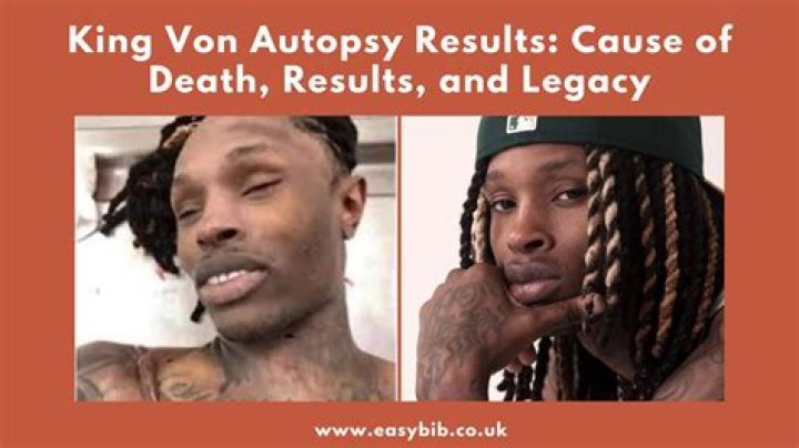 Autopsy of King Von: An In-Depth Analysis of His Life and Untimely Death