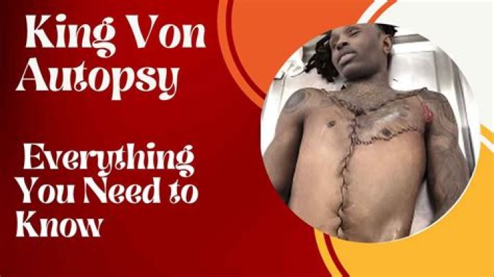 King Von Autopsy Images: Understanding the Impact and Legacy