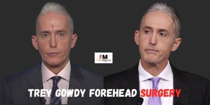 Trey Gowdy Nose Surgery: Understanding the Impact and Changes